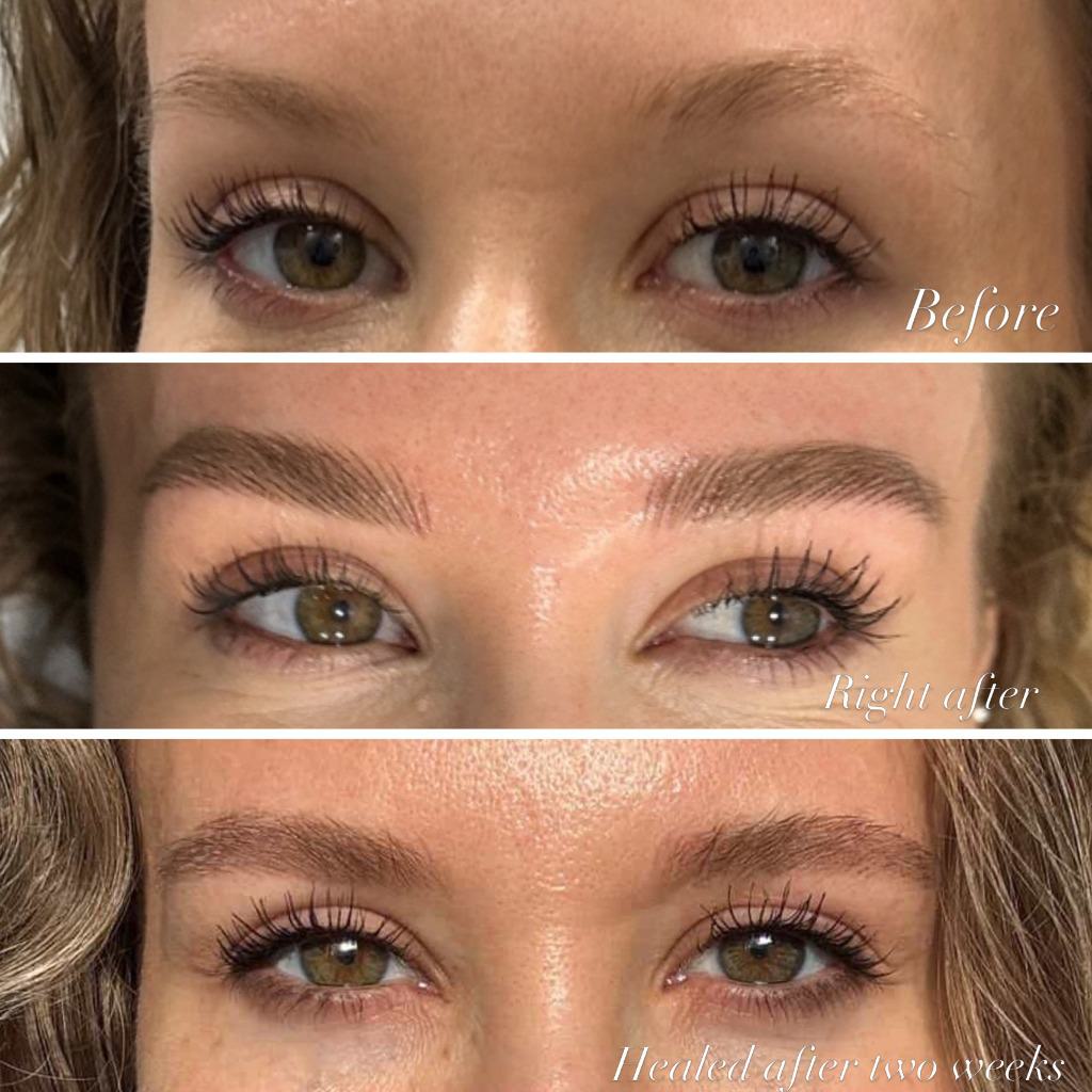 3-Stage Healed Brow Process